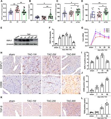 Recombinant EGFL7 Mitigated Pressure Overload-Induced Cardiac Remodeling by Blocking PI3Kγ/AKT/NFκB Signaling in Macrophages